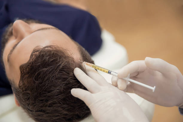 تكلفة الميزوتيرابي للشعر في نيرا ماد