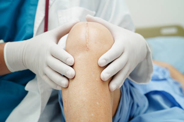 خطوات علاج الندبات في نيرا ماد