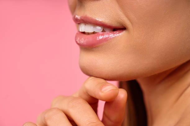 لماذا تختار نيرا ماد لتجميل الأسنان في تركيا؟