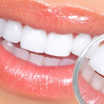 Types of Turkish Dental Implants