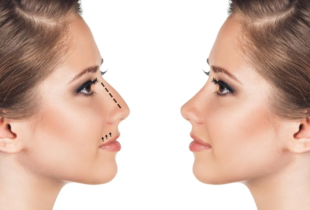 عمليات التجميل