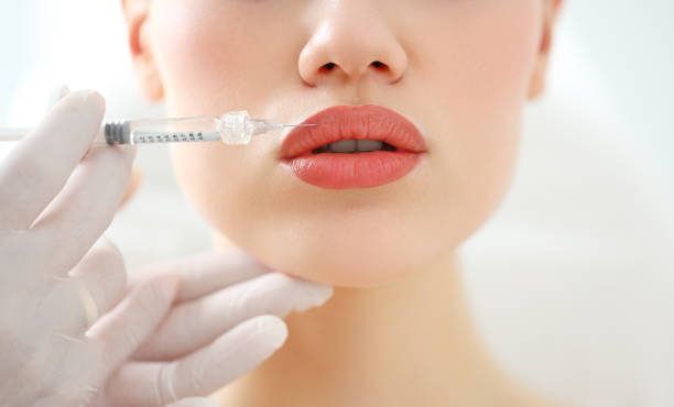 Filler Injection in Turkey with Nera Med: Your Comprehensive Guide to Rejuvenation