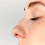 Nose Aesthetics in Turkey with Nera Med: Your Beauty Starts with the Details