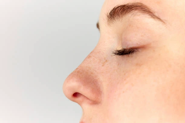 Nose Aesthetics in Turkey with Nera Med: Your Beauty Starts with the Details
