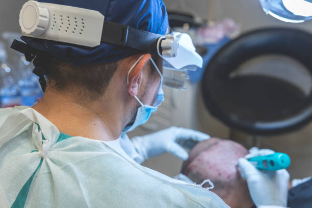 هل يمكن تكرار زراعة الشعر بعد الفشل؟