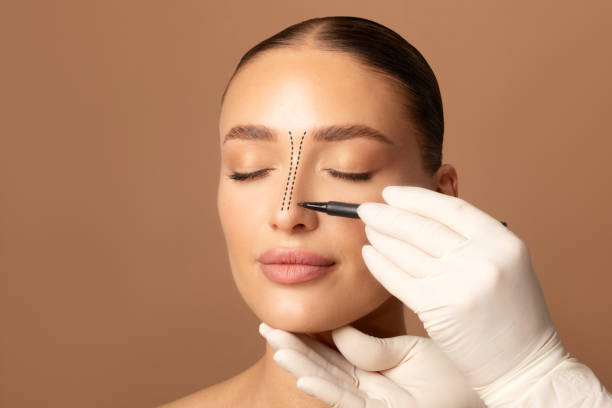 خطوات عملية تجميل الأنف في نيرا ماد