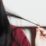 Trichotillomania